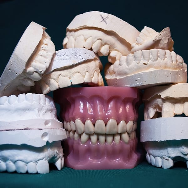 plusieurs prothèses dentaires de toutes les tailles