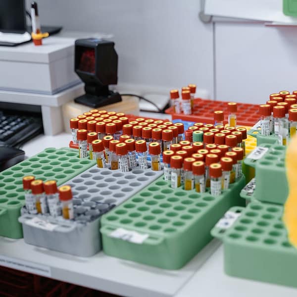 des flacons de verre pour des tests dans un laboratoire